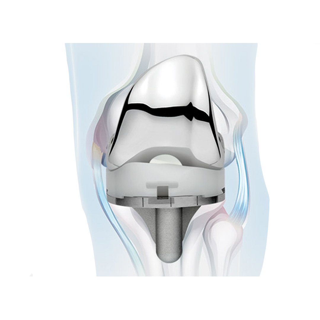 ADVANCE Medial-Pivot — imagem 1